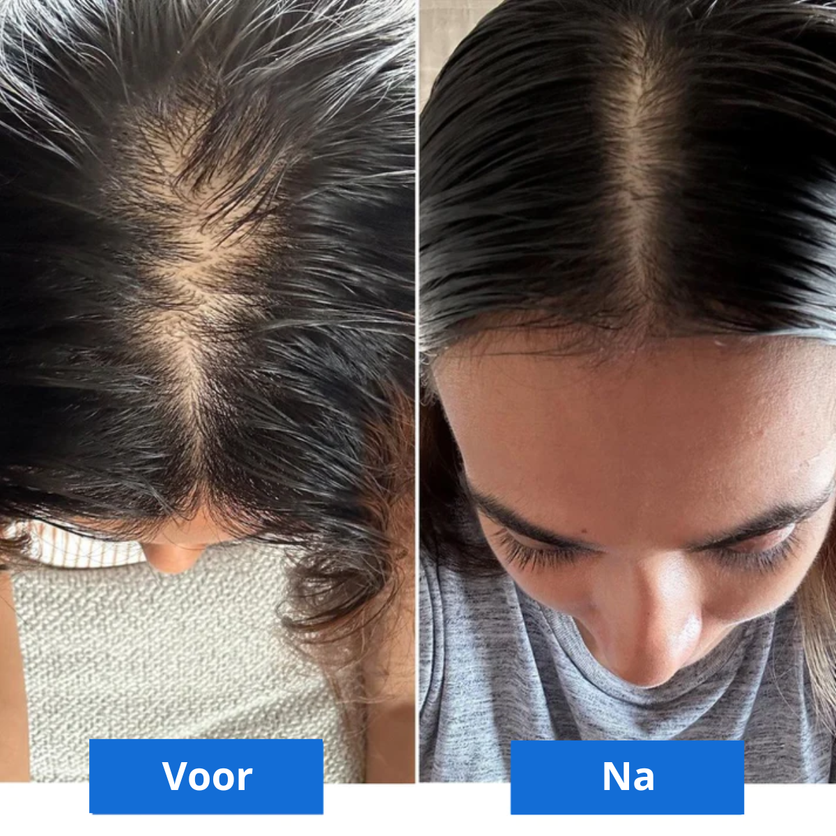 Scalp Bliss – Luxury Head Massage for Relaxation
