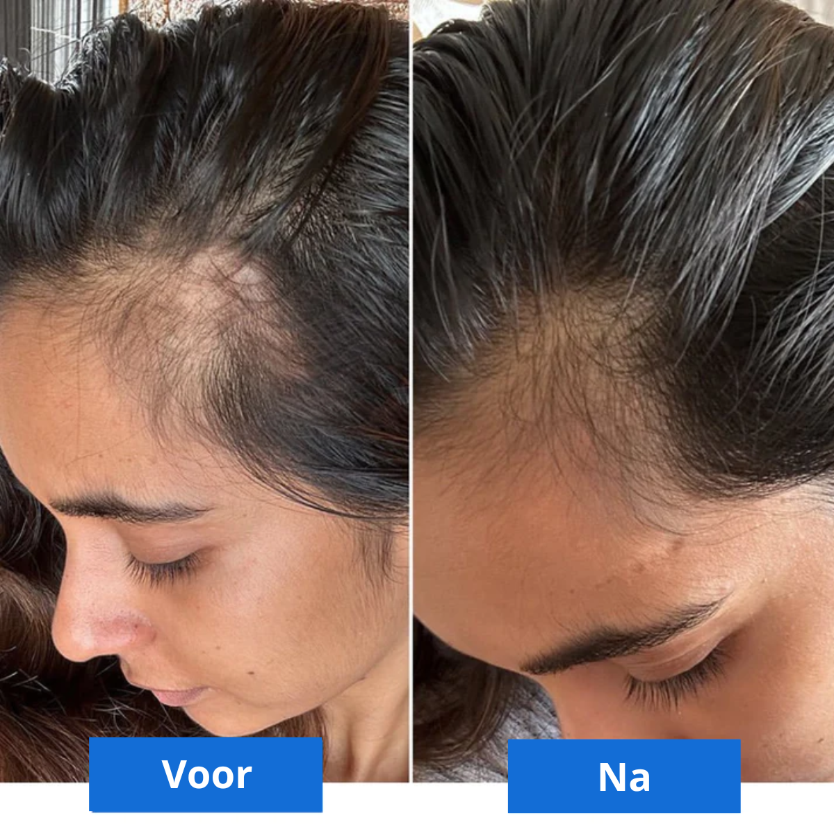Scalp Bliss – Luxury Head Massage for Relaxation