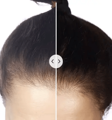 ChicBlend - 5-in-1 Multifunctional Hair Comb